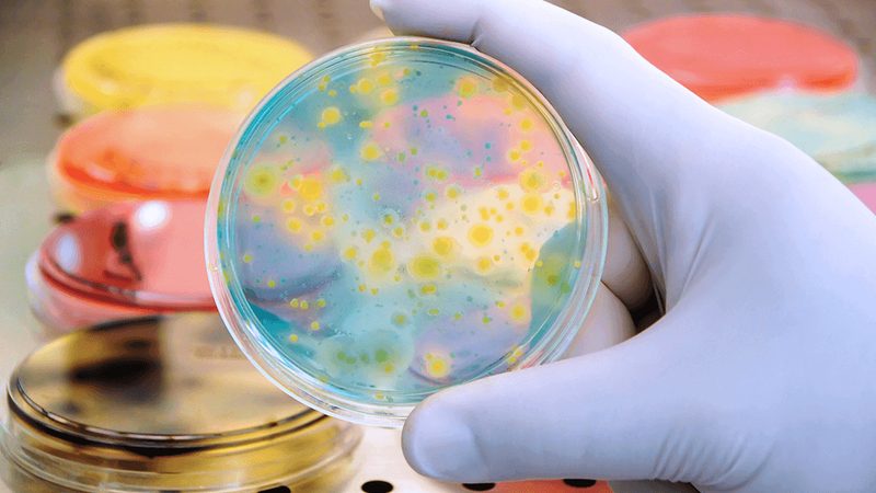 进口移液器材质分类：揭秘实验室安全与效率的关键**